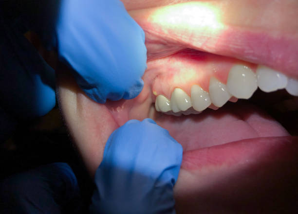 Emergency Dentist Open Today in OK