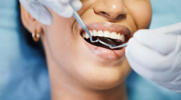 Best Teeth Whitening  in Mcalester, OK