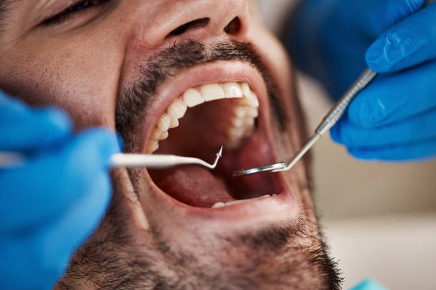 Best Cracked Tooth Emergency Dentist  in Mcalester, OK